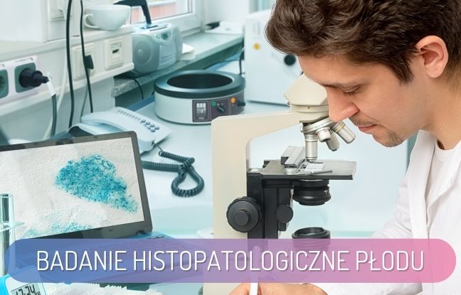 Badanie histopatologiczne płodu - diagnosta laboratoryjny