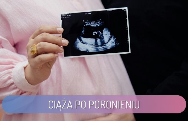 ciąża po poronieniu - kobieta trzyma zdjęcie usg w ręku