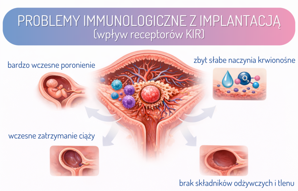 „Ilustracja przedstawiająca wpływ receptorów KIR na implantację – schemat macicy z komórkami immunologicznymi, pokazujący możliwe problemy: bardzo wczesne poronienie, wczesne zatrzymanie ciąży, słabe naczynia krwionośne i brak składników odżywczych.