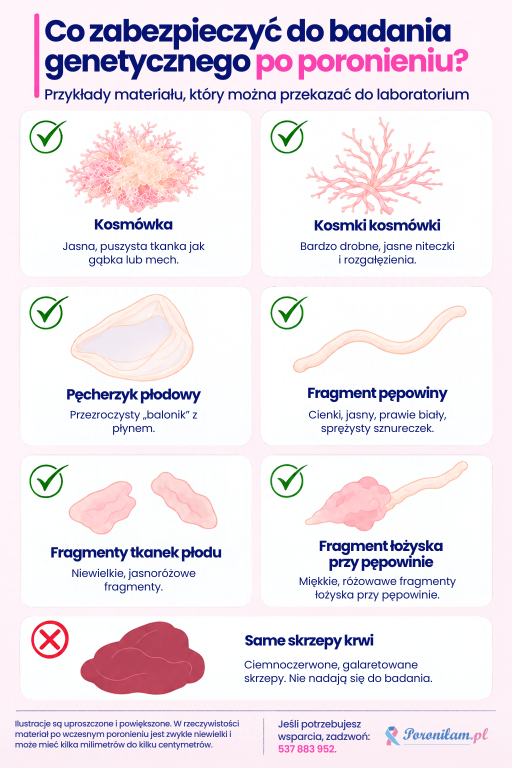 Co zabezpieczyć do badania genetycznego po poronieniu? Co zabezpieczyć do badania genetycznego po poronieniu? Ilustracje kosmówki, kosmków kosmówki, pęcherzyka płodowego, fragmentów pępowiny, tkanek płodu i łożyska oraz skrzepów krwi nieodpowiednich do badania.