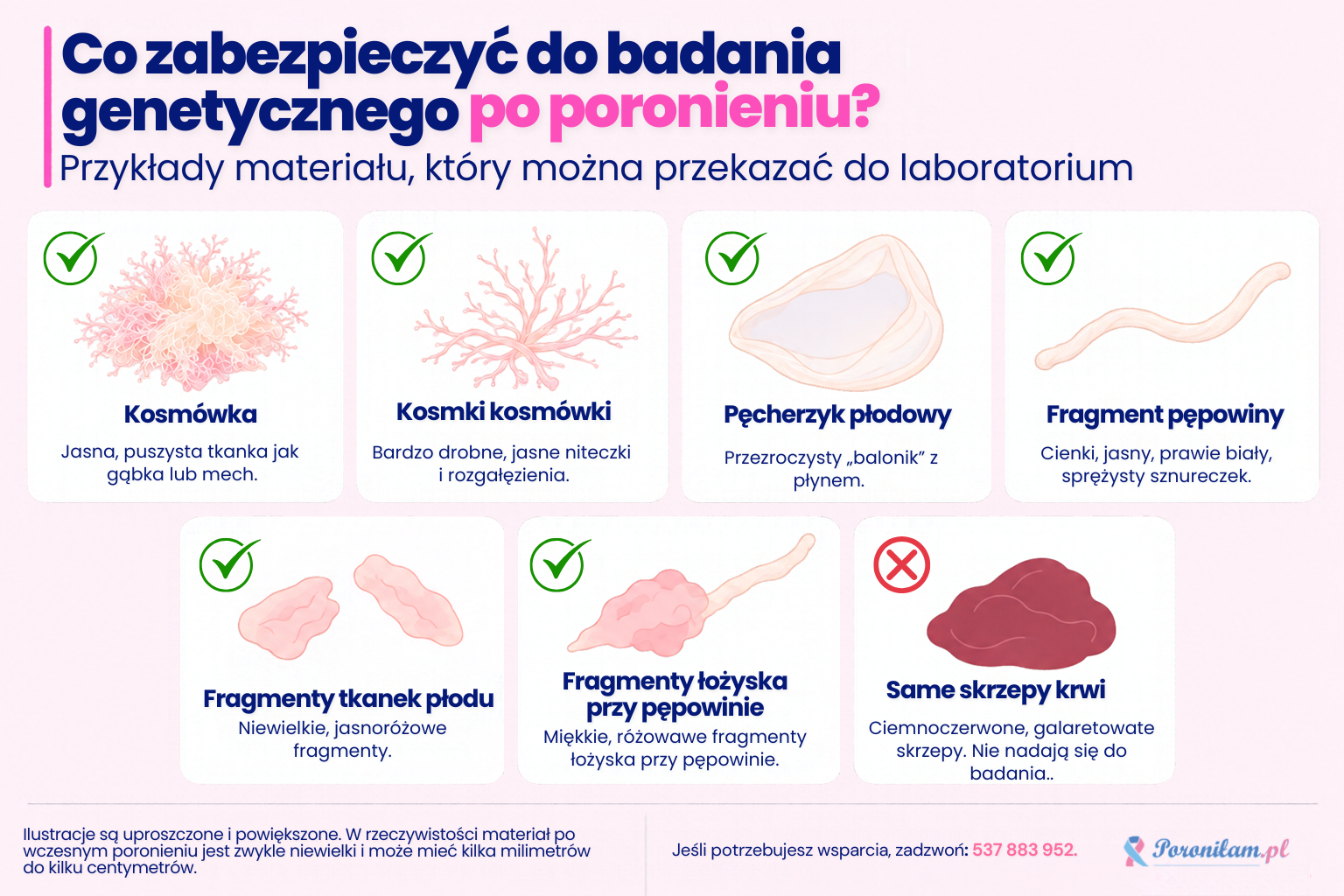 Co zabezpieczyć do badania genetycznego po poronieniu? Co zabezpieczyć do badania genetycznego po poronieniu? Ilustracje kosmówki, kosmków kosmówki, pęcherzyka płodowego, fragmentów pępowiny, tkanek płodu i łożyska oraz skrzepów krwi nieodpowiednich do badania.